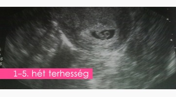 Egy új élet kezdete 1.-5.hét